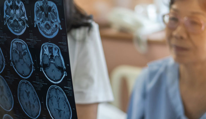 Optimizing Transition from Pediatric to Adult Care